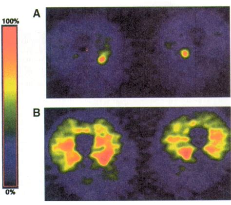 Figure 2 From Evidence For Dissociation Of Insulin Stimulation Of Blood