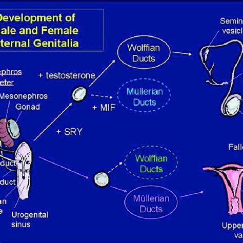 Vulvar cystic mass. Paramesonephric duct cyst or Gartner's duct cyst ...