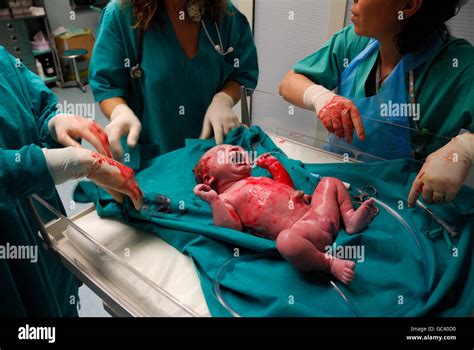 Moments After Birth Fotos Und Bildmaterial In Hoher Aufl Sung Alamy