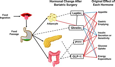 Frontiers | Bariatric Surgery: Targeting pancreatic β cells to treat