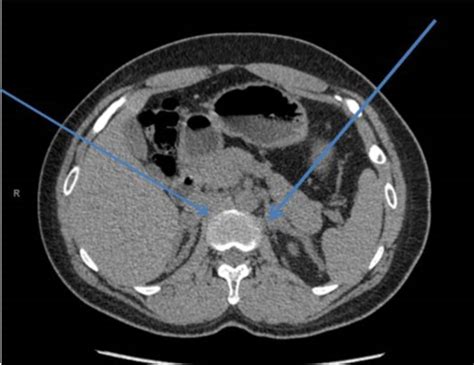 Diagnostic Imaging In Congenital Adrenal Hyperplasia How Does It Help