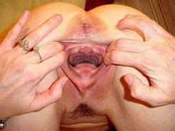 Very Extremely Gaping Pussies Porn Pictures Xxx Photos Sex Images Pictoa