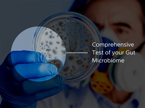 Gut Microbiome Test – Sova Health