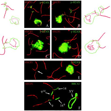 Immunolocalization of γ H2AX green areas BRCA1 green lines SYCP3