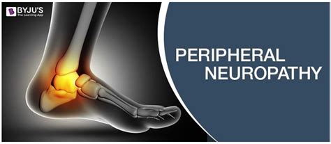 Peripheral Neuropathy Symptoms Causes Diagnosis And Treatments