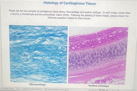 [Solved]: Histology of Cartilaginous Tissue Please see the