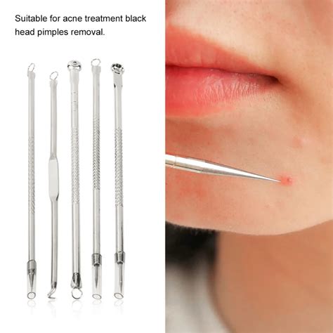 Big Sale 5pcs Set Stainless Steel Acne Needles Pimple Remover Skin