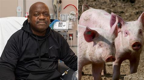 Le premier homme avec un rein de porc transplanté a été autorisé à