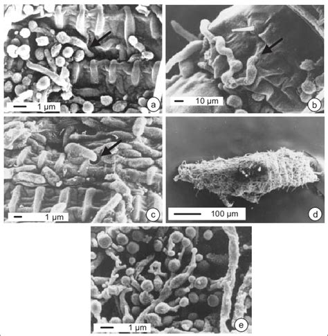 Scanning Electron Micro Graph Demonstrated Infection Processes Of