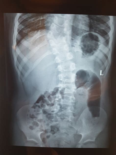 Нужна помощь вертебролога | Пикабу