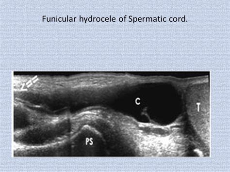 Pin On Radio Genitourinary