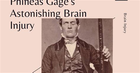 Phineas Gages Astonishing Brain Injury