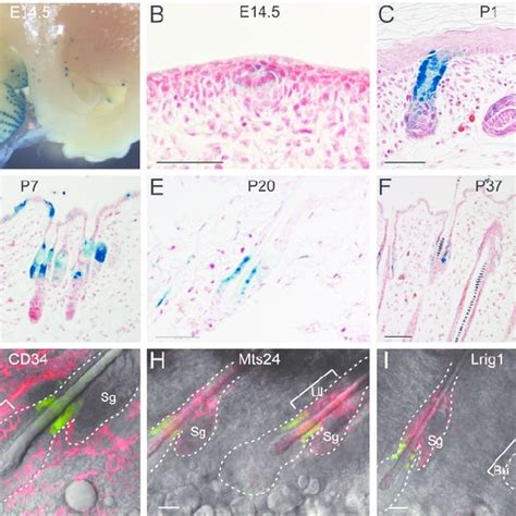 Lgr Marks A Different Stem Cell Population Than Lgr Cd Hf Stem