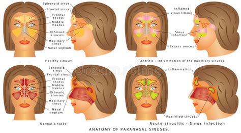 Seno Nasale Illustrazione Vettoriale Illustrazione Di Umano
