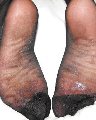 Nylon Soles Porn Pictures Xxx Photos Sex Images Pictoa