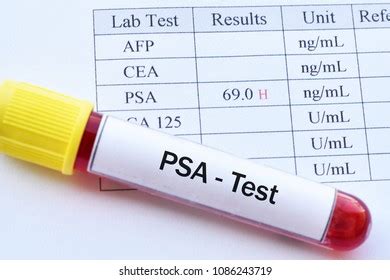 1+ Hundred Psa Test Result Royalty-Free Images, Stock Photos & Pictures