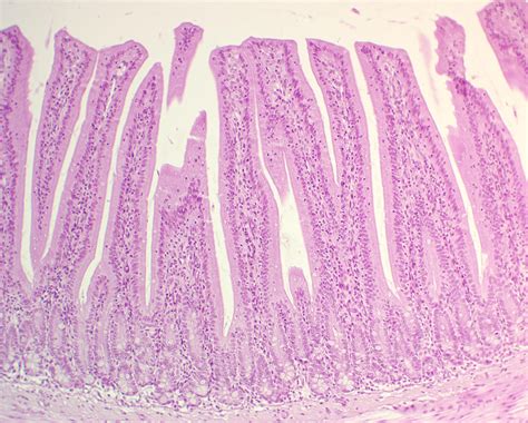 Simple Columnar Epithelium Microvilli