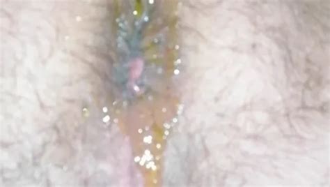 Beer Bottle Anal Gaping Free Older Gay Sex Hd Porn Xhamster