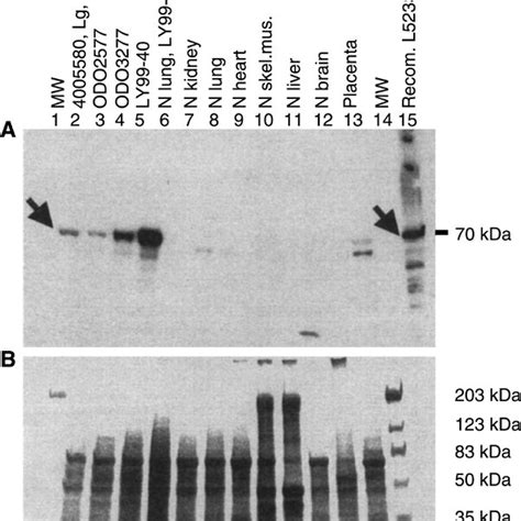 Western Blot Analysis Revealed A Kda L S Protein In One Large Cell