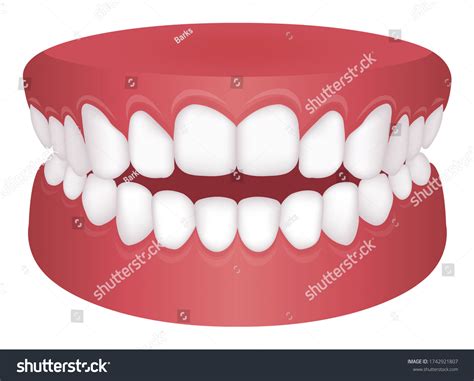 1 404 Imágenes De Open Bite Orthodontics Imágenes Fotos Y Vectores