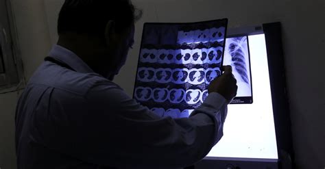 Which Type of Medical Scan Is Right for Me? - The New York Times