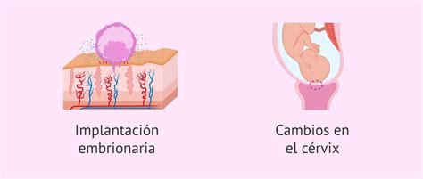 Causas De Las Hemorragias Deciduales En El Embarazo
