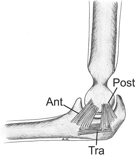 Ultrasound Of The Elbow With Emphasis On Detailed Assessment Of