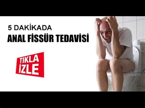 Anal Fissür Ameliyatı Nasıl Yapılır Tıkla İzle YouTube