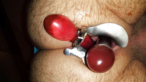 ICH ANAL Porn Pictures XXX Photos Sex Images PICTOA