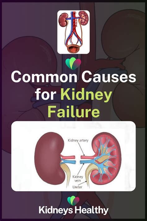 Épinglé Sur Kidneys Health