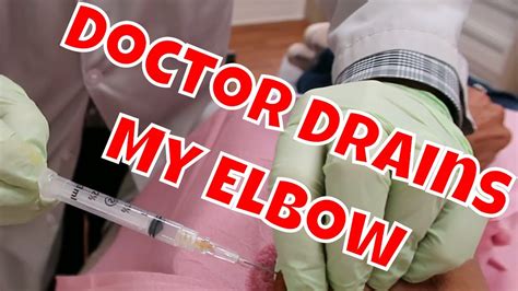 Doctor Drains Elbow With Big Needle Bursitis Youtube