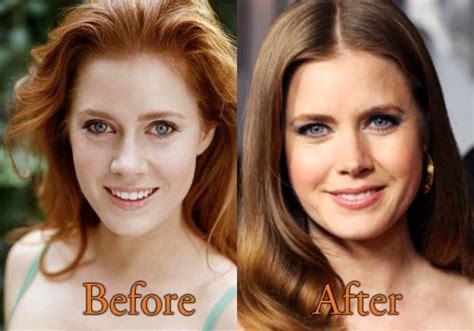 Did Elizabeth Turner Undergo Plastic Surgery Including Boob Job, Nose Job, Botox and Lips ...