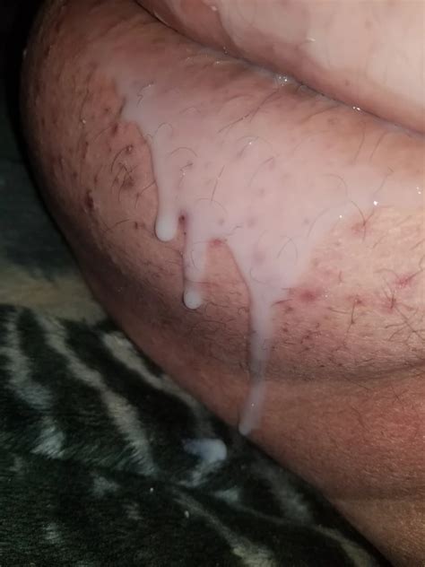 More Ass Stuff Pics Xhamster