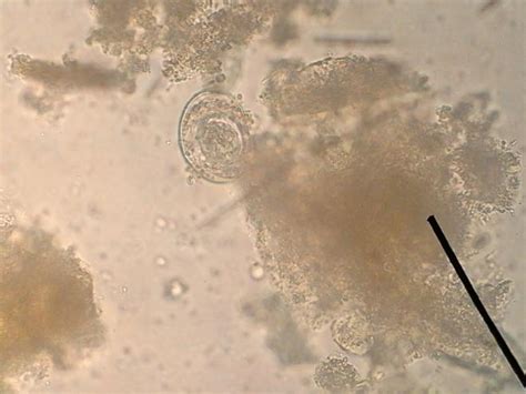 Hymenolepis Nana | Medical Laboratories