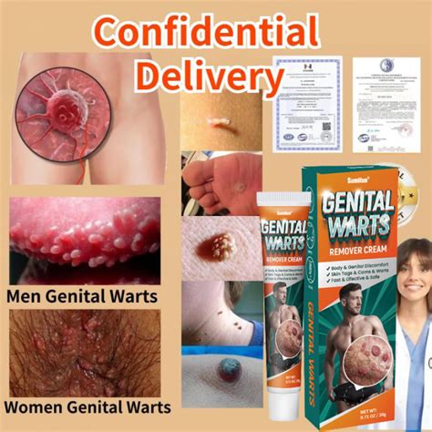 Genital Warts Remover Cream Original 20g Genital Herpes Condyloma Skin Tag Wart Removal Ointment