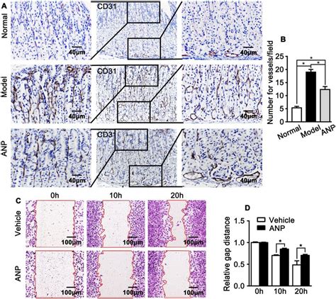 Andrographolide Suppresses Endothelial Activity A Representative