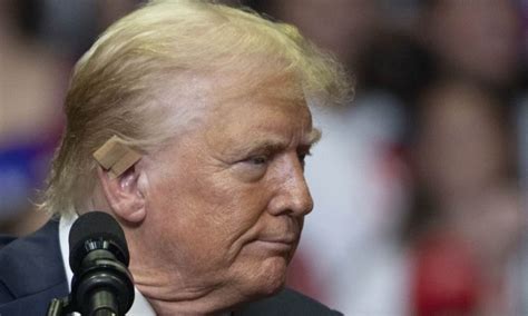 Tiro De Raspão Causou Ferida De 2 Cm Em Orelha De Trump Diz Ex Médico