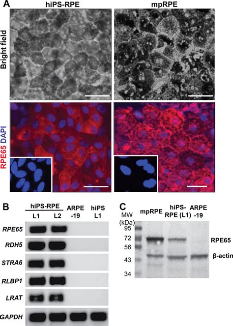 Characterization Of Rpe Cells And Their Expression Of Visual