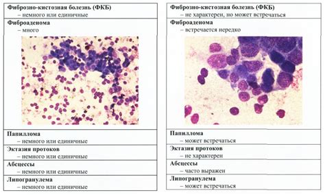Доброкачественные поражения молочной железы