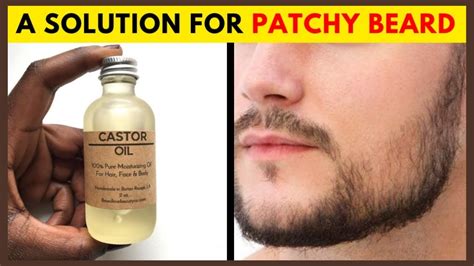 How To Use Castor Oil For Beard Growth And Its Amazing Benefits YouTube