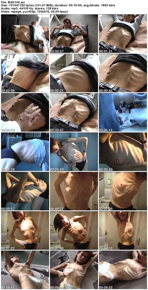 Anorexic Hot Girls Video Collection Page