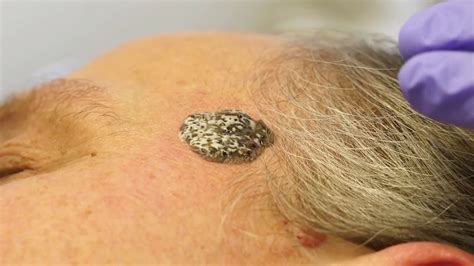 Применение препаратов Мардил Селен и Мардил Цинк Макс - YouTube