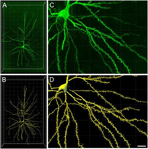 A Intracellularly Injected Layer Iii Pyramidal Neuron Of The Human