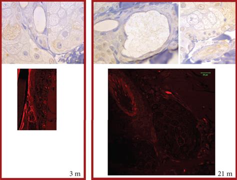 Analysis Of The Dna Lesion And Oxoguanine Oxog In The Skin Of