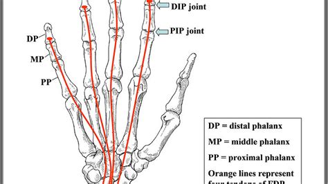 Flexor tendon injury finger