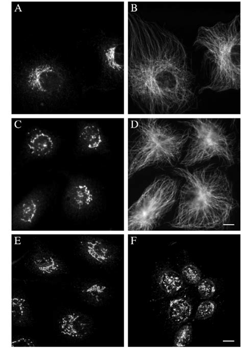 Interphase Animal Cell Microscope Whitefish Interphase Under