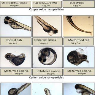 Malformations Observed In Zebra Fish Embryos Treated With Copper Oxide