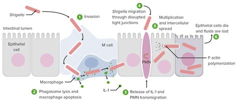 Shigella Concise Medical Knowledge