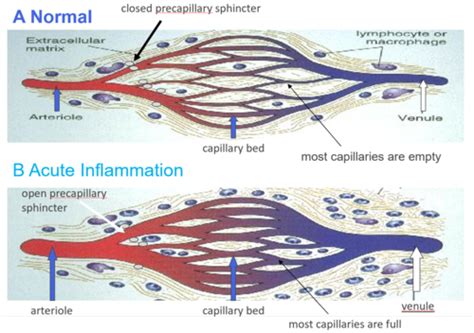 Inflammation And Wound Healing Flashcards Quizlet