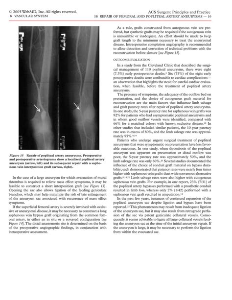 acs repair  femoral  popliteal artery aneurysms